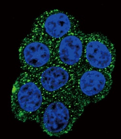 Invitrogen SDHD Polyclonal Antibody 400 &mu;L; Unconjugated:Antibodies,