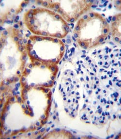 Invitrogen SDHD Polyclonal Antibody 400 &mu;L; Unconjugated:Antibodies,