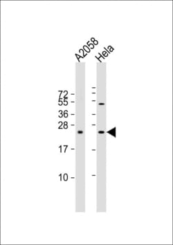 Invitrogen SDHD Polyclonal Antibody 400 &mu;L; Unconjugated:Antibodies,
