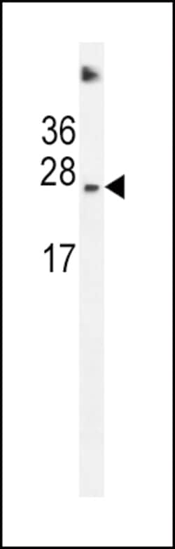 Invitrogen SDHD Polyclonal Antibody 400 &mu;L; Unconjugated:Antibodies,