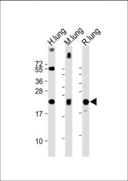 Invitrogen SFTPC Polyclonal Antibody 200 &mu;L; Unconjugated:Antibodies,
