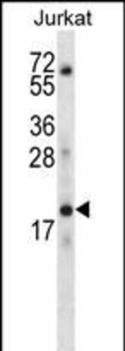 Invitrogen KRTAP13-3 Polyclonal Antibody 400 &mu;L; Unconjugated:Antibodies,