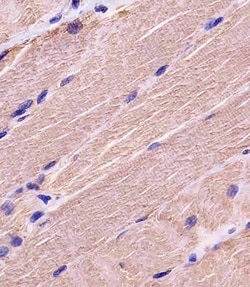 Invitrogen MYBPC3 Polyclonal Antibody 400 &mu;L; Unconjugated:Antibodies,