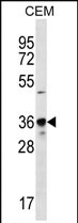 PDC Rabbit anti-Human, Polyclonal, Invitrogen 400 &mu;L; Unconjugated:Antibodies,