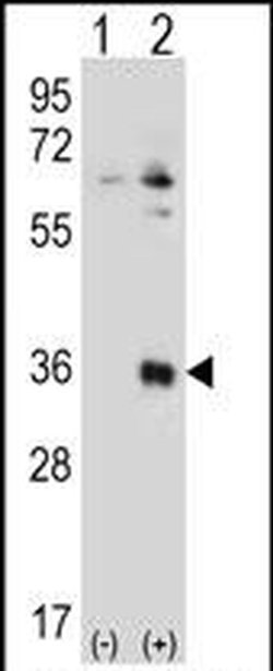 TSSK6 Rabbit anti-Human, Polyclonal, Invitrogen 400 &mu;L; Unconjugated:Antibodies,