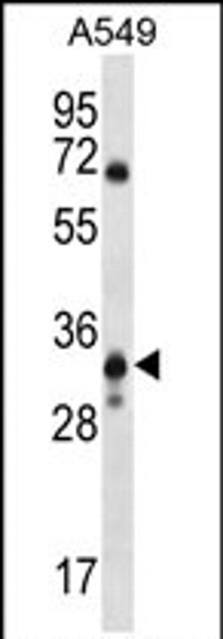 SLC25A53 Rabbit anti-Human, Polyclonal, Invitrogen 400 &mu;L; Unconjugated:Antibodies,
