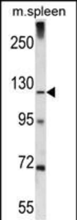 Invitrogen KIAA1324 Polyclonal Antibody 400 &mu;L; Unconjugated:Antibodies,