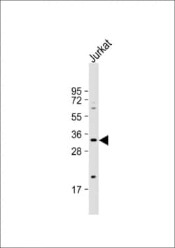 Invitrogen Ficolin 3 Polyclonal Antibody 400 &mu;L; Unconjugated:Antibodies,