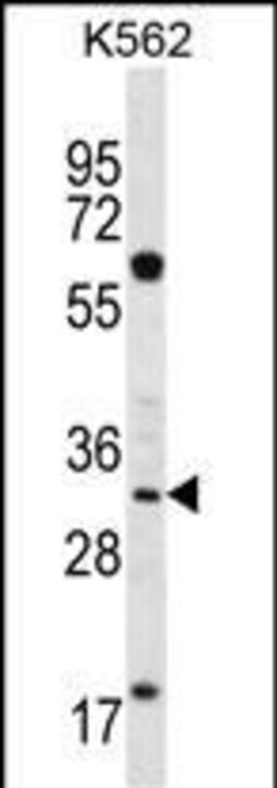 Invitrogen Ficolin 3 Polyclonal Antibody 400 &mu;L; Unconjugated:Antibodies,