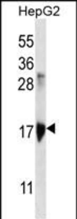 Invitrogen KRTAP1-3 Polyclonal Antibody 400 &mu;L | Buy Online | Invitrogen&trade; | Fisher Scientific