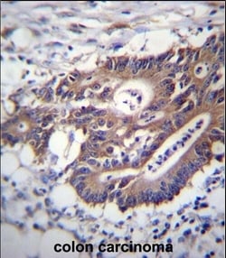 Invitrogen Cytokeratin 12 Polyclonal Antibody 400 &mu;L; Unconjugated:Antibodies,