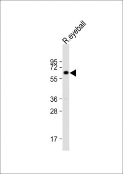 Invitrogen Cytokeratin 12 Polyclonal Antibody 400 &mu;L; Unconjugated:Antibodies,