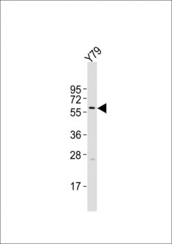 Invitrogen Cytokeratin 12 Polyclonal Antibody 400 &mu;L; Unconjugated:Antibodies,