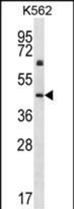 Invitrogen Cytokeratin 12 Polyclonal Antibody 400 &mu;L; Unconjugated:Antibodies,