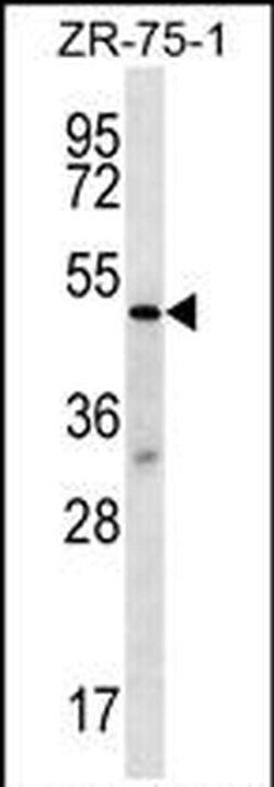 TBL2 Rabbit anti-Human, Polyclonal, Invitrogen 400 &mu;L; Unconjugated:Antibodies,