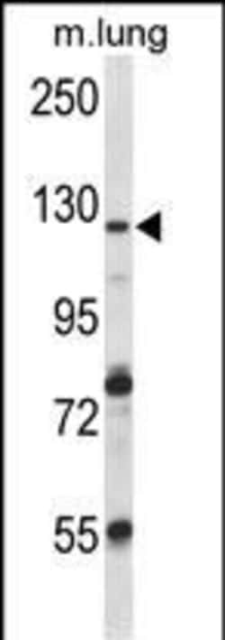 Invitrogen VPS54 Polyclonal Antibody 400 &mu;L; Unconjugated:Antibodies,
