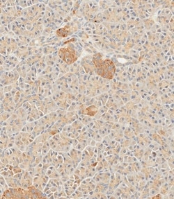 Invitrogen SFRP5 Polyclonal Antibody 400 &mu;L; Unconjugated:Antibodies,