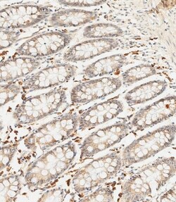 Invitrogen SFRP5 Polyclonal Antibody 400 &mu;L; Unconjugated:Antibodies,