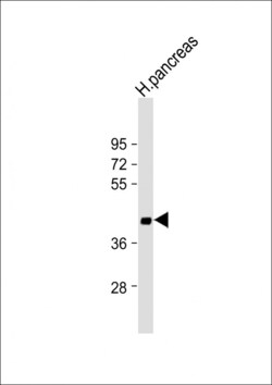 Invitrogen SFRP5 Polyclonal Antibody 400 &mu;L; Unconjugated:Antibodies,