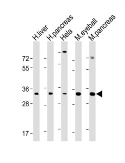 Invitrogen SFRP5 Polyclonal Antibody 400 &mu;L; Unconjugated:Antibodies,