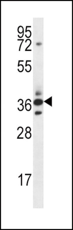 Invitrogen SFRP5 Polyclonal Antibody 400 &mu;L; Unconjugated:Antibodies,