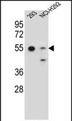 GNAS Rabbit anti-Human, Polyclonal, Invitrogen 400 &mu;L; Unconjugated:Antibodies,