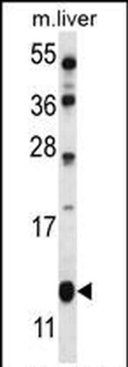 GOLT1B Rabbit anti-Mouse, Polyclonal, Invitrogen 400 &mu;L; Unconjugated:Antibodies,