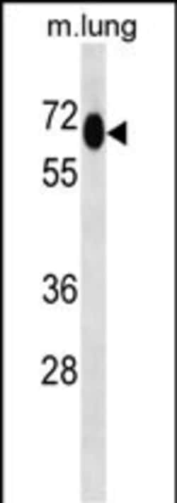 Invitrogen MEPCE Polyclonal Antibody 400 &mu;L | Buy Online | Invitrogen&trade; | Fisher Scientific