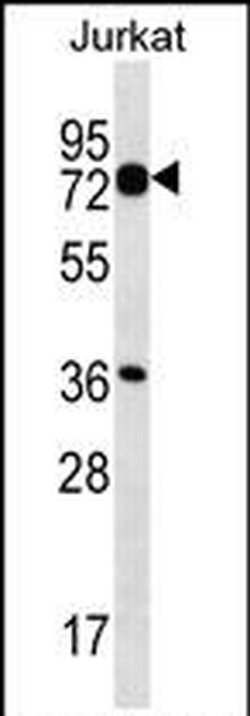PLS1 Rabbit anti-Human, Polyclonal, Invitrogen 400 &mu;L; Unconjugated:Antibodies,