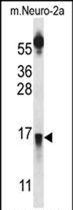 PRLH Polyclonal Antibody, Invitrogen 400 &mu;L | Buy Online | Thermo Scientific | Fisher Scientific