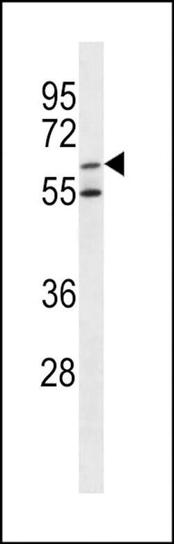 Arylsulfatase F Rabbit anti-Human, Polyclonal, Invitrogen 400 &mu;L; Unconjugated:Antibodies,