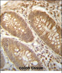 Invitrogen PGAM4 Polyclonal Antibody 400 &mu;L; Unconjugated:Antibodies,