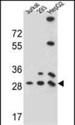 Invitrogen PGAM4 Polyclonal Antibody 400 &mu;L; Unconjugated:Antibodies,
