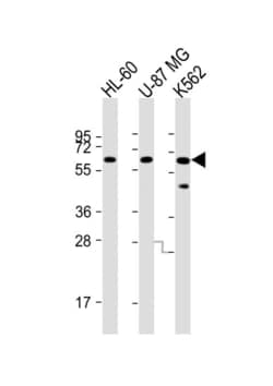 Invitrogen IL1RL2 Polyclonal Antibody 400 &mu;L; Unconjugated:Antibodies,