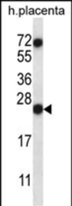 Invitrogen RNASE8 Polyclonal Antibody 400 &mu;L; Unconjugated:Antibodies,