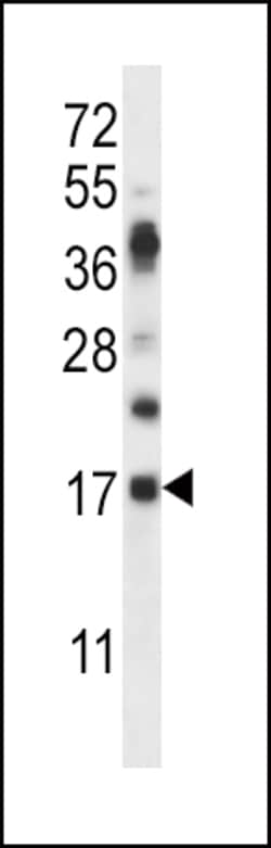 Invitrogen RNASE6 Polyclonal Antibody 400 &mu;L; Unconjugated:Antibodies,