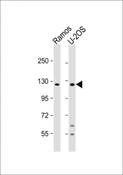 Invitrogen Ubinuclein 2 Polyclonal Antibody 400 &mu;L; Unconjugated:Antibodies,