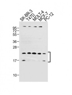 Invitrogen UBE2W Polyclonal Antibody 400 &mu;L; Unconjugated:Antibodies,