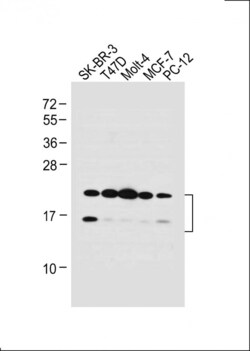 Invitrogen UBE2W Polyclonal Antibody 400 &mu;L; Unconjugated:Antibodies,
