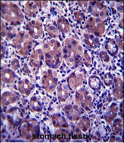 Invitrogen ANKRD22 Polyclonal Antibody 400 &mu;L; Unconjugated:Antibodies,