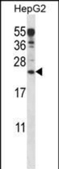 Invitrogen ANKRD22 Polyclonal Antibody 400 &mu;L; Unconjugated:Antibodies,