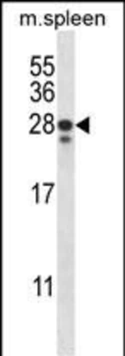 Invitrogen ANKRD22 Polyclonal Antibody 400 &mu;L; Unconjugated:Antibodies,