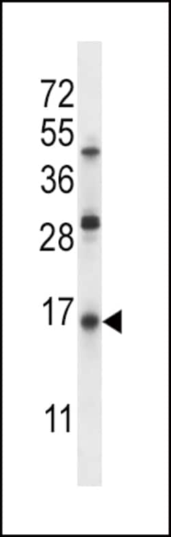 Invitrogen SFTPC Polyclonal Antibody 400 &mu;L; Unconjugated:Antibodies,