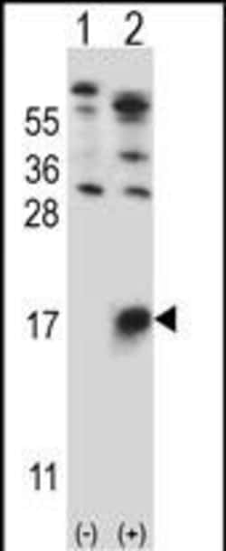 Invitrogen GYPB Polyclonal Antibody 400 &mu;L; Unconjugated:Antibodies,