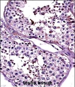 Invitrogen CTAG2 Polyclonal Antibody 400 &mu;L; Unconjugated:Antibodies,