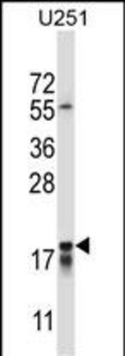 Invitrogen CTAG2 Polyclonal Antibody 400 &mu;L; Unconjugated:Antibodies,