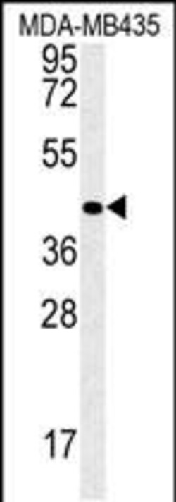 Invitrogen VASH2 Polyclonal Antibody 400 &mu;L | Buy Online | Invitrogen&trade; | Fisher Scientific