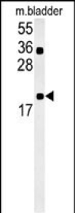 Invitrogen CCDC12 Polyclonal Antibody 400 &mu;L; Unconjugated:Antibodies,