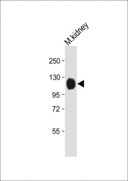 Invitrogen NPR1 Polyclonal Antibody 400 &mu;L; Unconjugated:Antibodies,