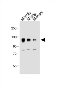 Invitrogen NPR1 Polyclonal Antibody 400 &mu;L; Unconjugated:Antibodies,